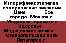 Иглорефлексотерапия, оздоровление пиявками › Цена ­ 3 000 - Все города, Москва г. Медицина, красота и здоровье » Медицинские услуги   . Ставропольский край,Пятигорск г.